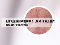 北京儿童皮肤病医院哪个比较好 北京儿童皮肤科最好的医院哪家