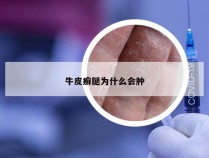 牛皮癣腿为什么会肿