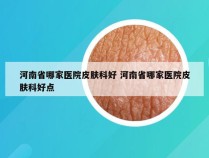 河南省哪家医院皮肤科好 河南省哪家医院皮肤科好点