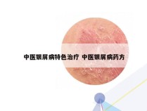 中医银屑病特色治疗 中医银屑病药方