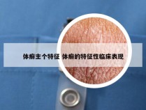 体癣主个特征 体癣的特征性临床表现