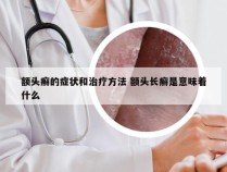 额头癣的症状和治疗方法 额头长癣是意味着什么