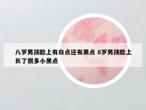 八岁男孩脸上有白点还有黑点 8岁男孩脸上长了很多小黑点