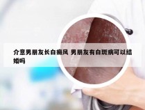 介意男朋友长白癜风 男朋友有白斑病可以结婚吗