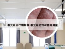 秦艽丸治疗银屑病 秦艽丸功效与作用用量