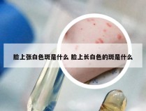 脸上张白色斑是什么 脸上长白色的斑是什么