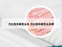 刀口处长癣怎么办 刀口处长癣怎么办啊