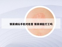 银屑病玩手机对危害 银屑病能打工吗