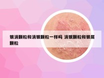 银消颗粒和消银颗粒一样吗 消银颗粒和银屑颗粒