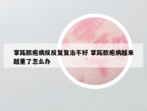 掌跖脓疱病反反复复治不好 掌跖脓疱病越来越重了怎么办