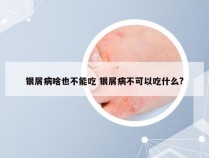 银屑病啥也不能吃 银屑病不可以吃什么?