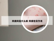 同康网是什么癣 同康挫膏作用