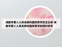 成都市第二人民皮肤科医院草市街怎么样 成都市第二人民皮肤科医院草市街预约挂号