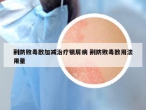 荆防败毒散加减治疗银屑病 荆防败毒散用法用量