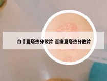 白廯夏塔热分散片 百癫夏塔热分散片