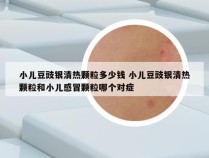 小儿豆豉银清热颗粒多少钱 小儿豆豉银清热颗粒和小儿感冒颗粒哪个对症