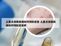 儿童点滴银屑病如何预防感冒 儿童点滴银屑病如何预防感冒呢