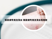 银屑病专用洗发水 银屑病专用洗发水有哪些