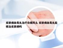 皮肤病血毒丸治疗白癜风么 皮肤病血毒丸能根治皮肤病吗