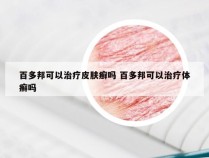 百多邦可以治疗皮肤癣吗 百多邦可以治疗体癣吗