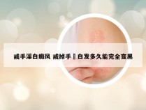 戒手淫白癜风 戒掉手婬白发多久能完全变黑