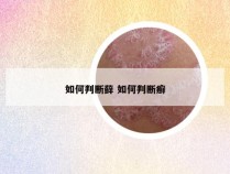 如何判断藓 如何判断癣