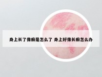 身上长了像癣是怎么了 身上好像长癣怎么办