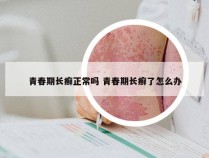 青春期长癣正常吗 青春期长癣了怎么办