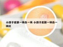 小孩子皮肤一块白一块 小孩子皮肤一块白一块红