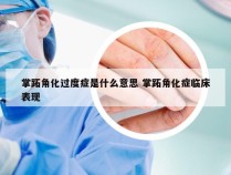 掌跖角化过度症是什么意思 掌跖角化症临床表现