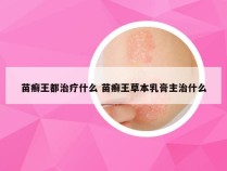 苗癣王都治疗什么 苗癣王草本乳膏主治什么