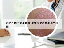 六个月孩子身上长癣 宝宝六个月身上有一块藓