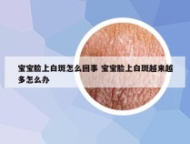 宝宝脸上白斑怎么回事 宝宝脸上白斑越来越多怎么办