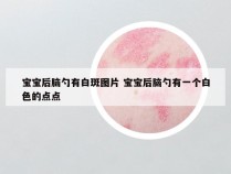 宝宝后脑勺有白斑图片 宝宝后脑勺有一个白色的点点