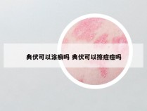 典伏可以涂癣吗 典伏可以擦痘痘吗