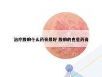 治疗股癣什么药膏最好 股癣的克星药膏