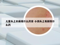 儿童头上长癣用什么药膏 小孩头上有藓擦什么药