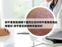 四平看银屑病哪个医院比较好四平看银屑病去哪里好 四平看皮肤病哪家医院好