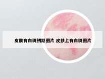 皮肤有白斑初期图片 皮肤上有白斑图片