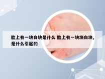 脸上有一块白块是什么 脸上有一块块白块,是什么引起的