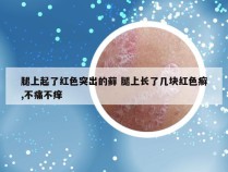 腿上起了红色突出的藓 腿上长了几块红色癣,不痛不痒