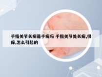 手指关节长癣是手癣吗 手指关节处长癣,很痒,怎么引起的