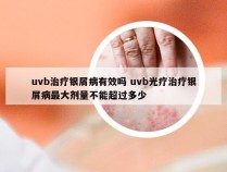 uvb治疗银屑病有效吗 uvb光疗治疗银屑病最大剂量不能超过多少