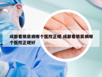 成都看银屑病哪个医院正规 成都看银屑病哪个医院正规好