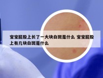 宝宝屁股上长了一大块白斑是什么 宝宝屁股上有几块白斑是什么