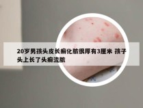 20岁男孩头皮长癣化脓很厚有3厘米 孩子头上长了头癣流脓