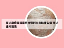 顽达康癣毒清是用来喷剂治皮肤什么病 顽达康抑菌液