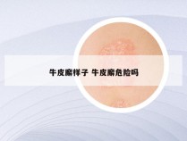 牛皮廨样子 牛皮廨危险吗