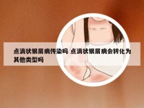 点滴状银屑病传染吗 点滴状银屑病会转化为其他类型吗