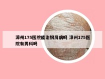 漳州175医院能治银屑病吗 漳州175医院有男科吗